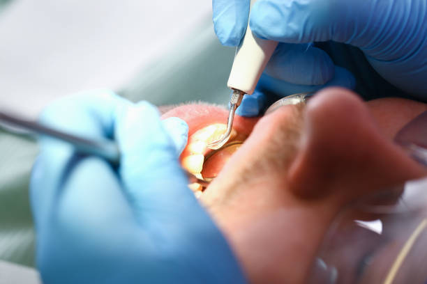 Best Broken or Cracked Tooth Emergency Dentist in Hopewell, NJ